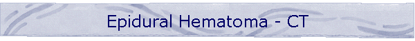 Epidural Hematoma - CT